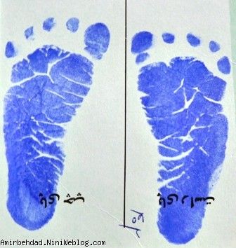 اثر انگشت و کف پای نوزادی بهدادی در بدو تولد