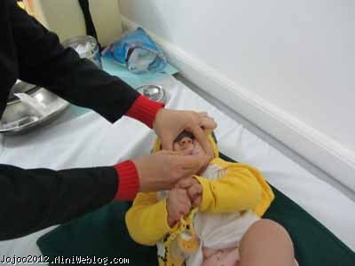 واکسن 6 ماهگی نوزاد