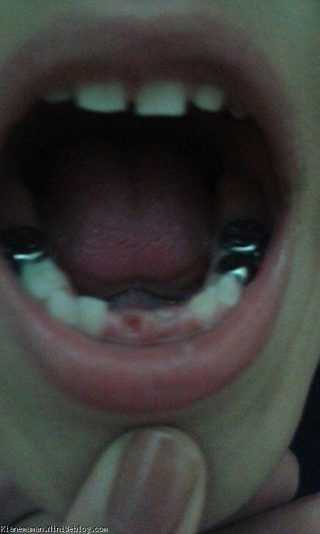 دومین دندان شیری