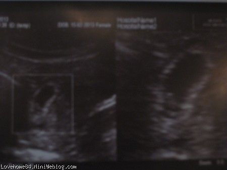عکس جنین در 6ونیم هفتگی