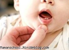 قطره ی آهن و تغییر رنگ دندان کودک 