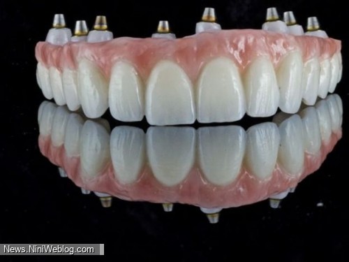 پروتز دندان، مقرون به صرفه و پرطرفدار