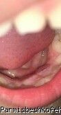 اولین دندان دائمی دخترم