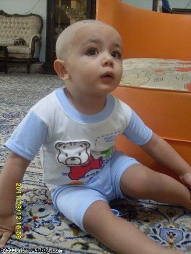 بعد از کچل شدن
