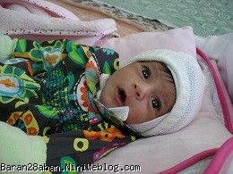 عکس های باران کوچولو
