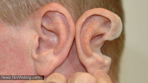 پروتزهای گوش چگونه ساخته می‌شوند؟
