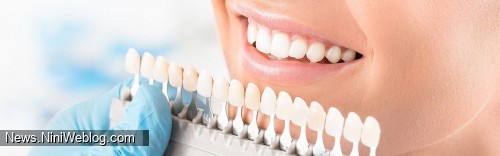 روکش کردن دندان ها به چه روش هایی انجام می شود؟