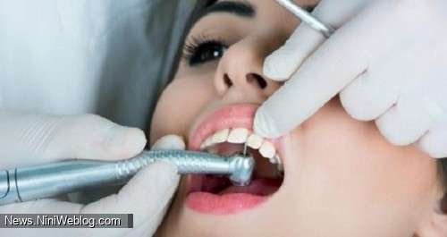 پروسه پرکردن دندان چگونه است؟