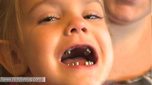 ساوانا، دختری با دندان‌های فلزی!