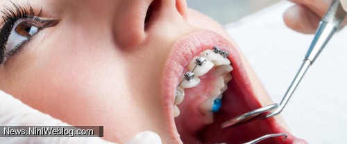 تفاوت دندان‌پزشک عمومی و متخصص ارتودنسی
