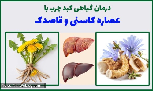 درمان گیاهی کبد چرب با عصاره کاسنی و قاصدک