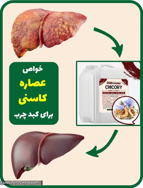خواص عصاره کاسنی برای کبدچرب