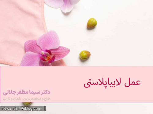 عمل لابیاپلاستی توسط دکتر سیما مظفر جلالی