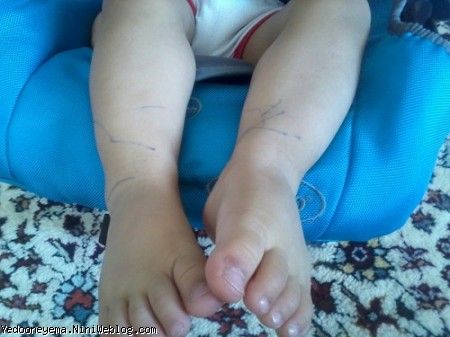 ببین چه جور پاهاتو خط خطی کردی شیطونم